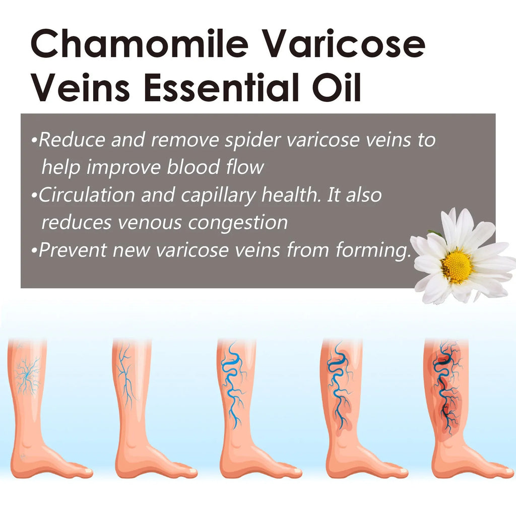 10ml bottle of chamomile leg essential oil for massage and skin care