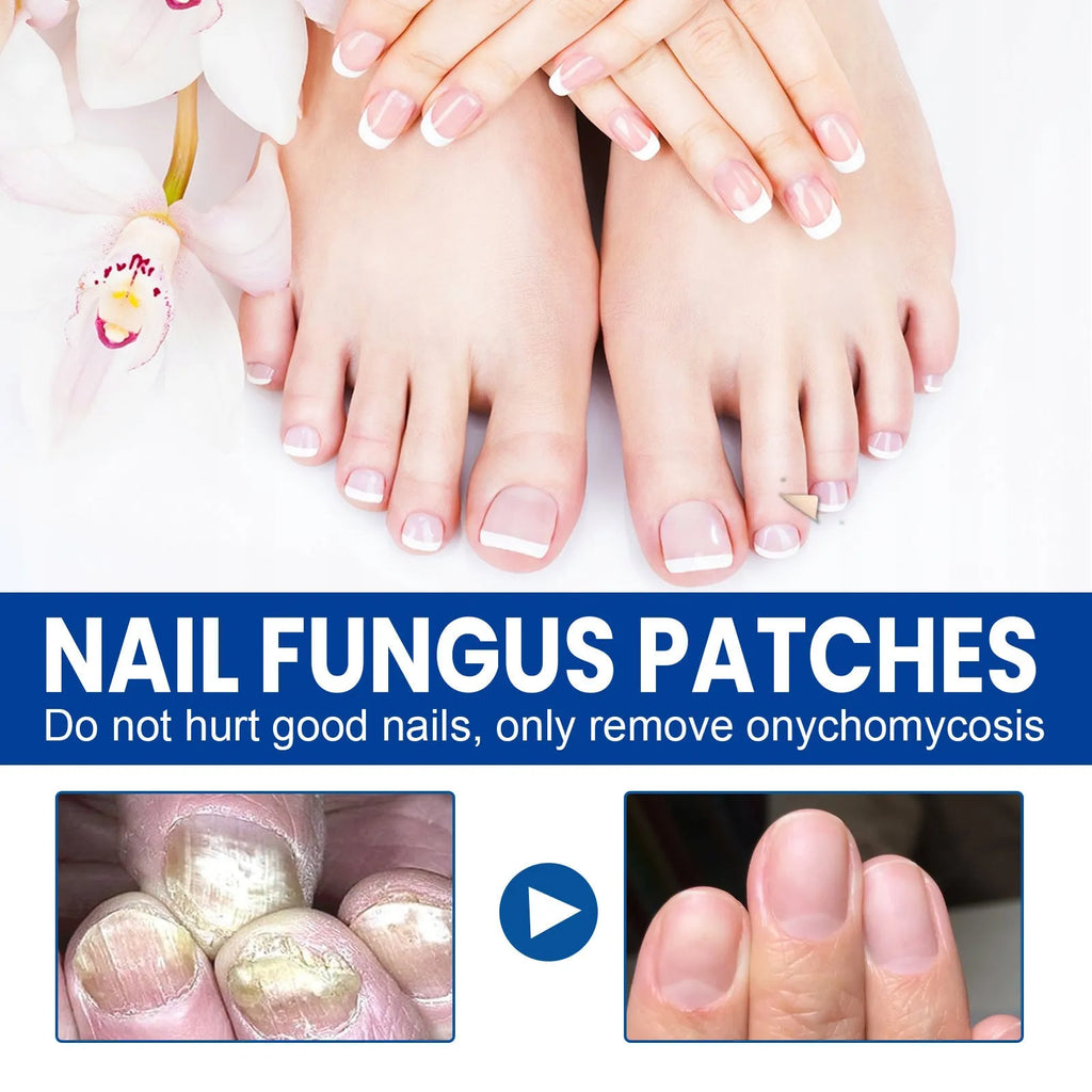 Box of nail repair adhesive bandage patches with ingredients glycerin, allantoin, vitamin E, tea tree oil.