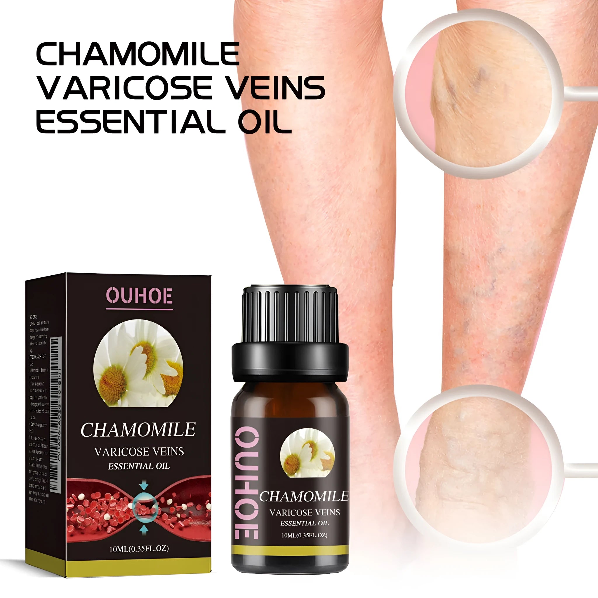 10ml bottle of chamomile leg essential oil for massage and skin care