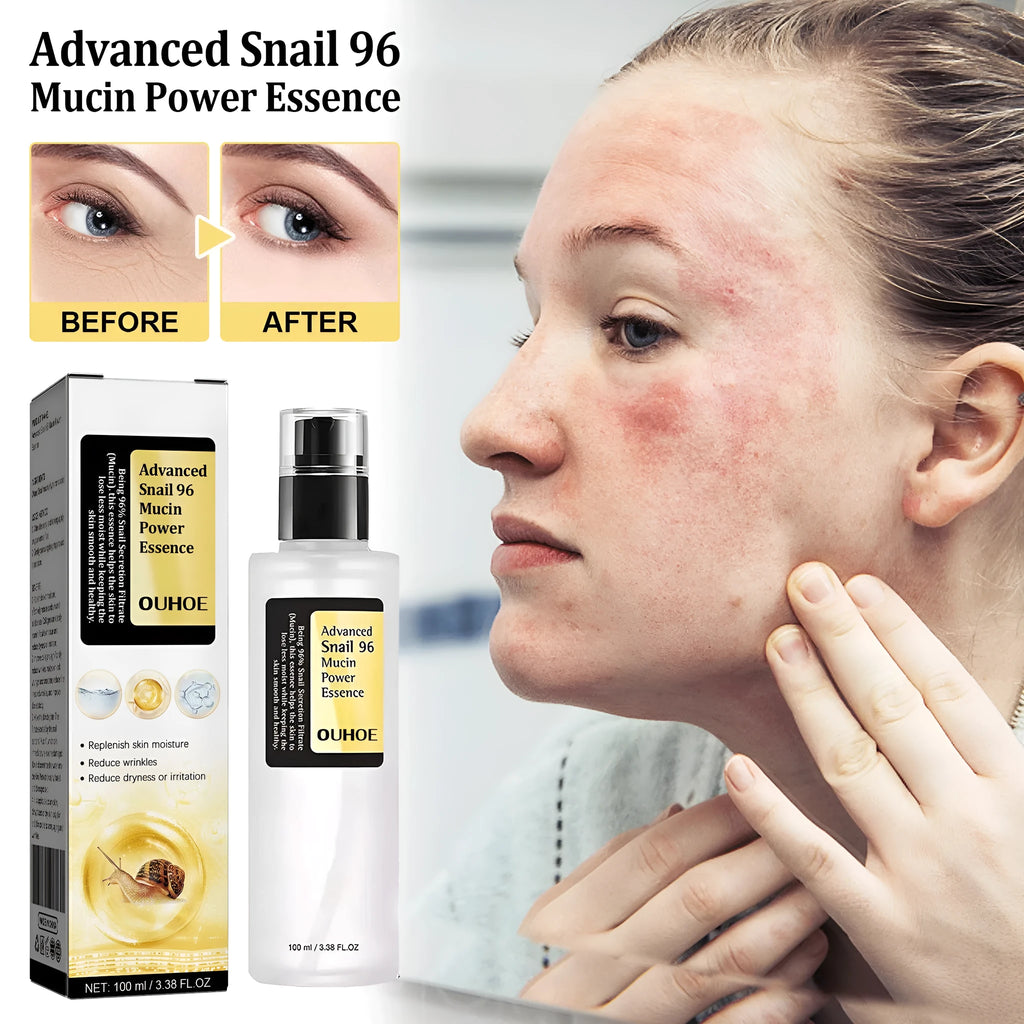 Original snail serum collagen facial treatment 100ml bottle with hyaluronic acid