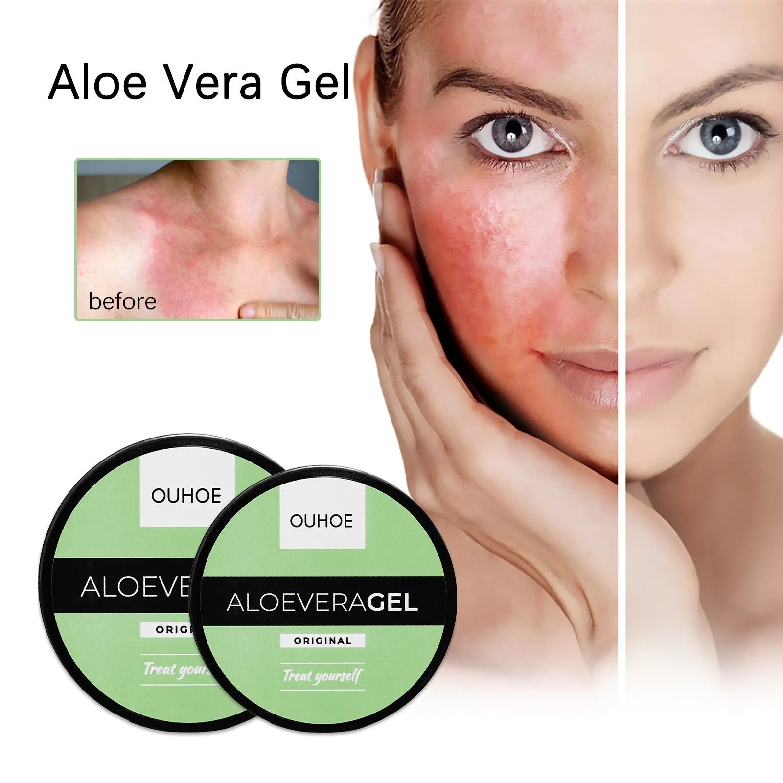Tanning cream and aloe vera after sun gel set in 50g and 100g sizes