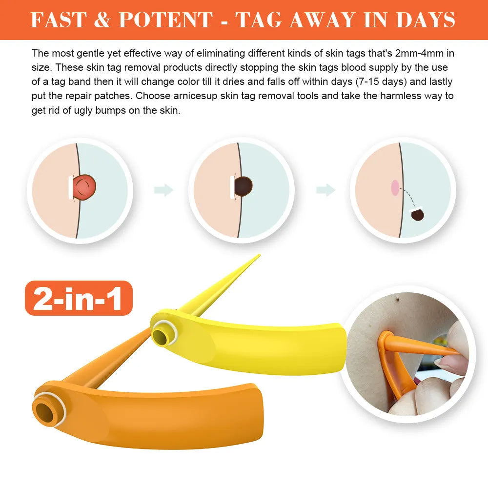 Orange-yellow mole remover tool kit with two devices, rubber rings, alcohol swabs, and accessories