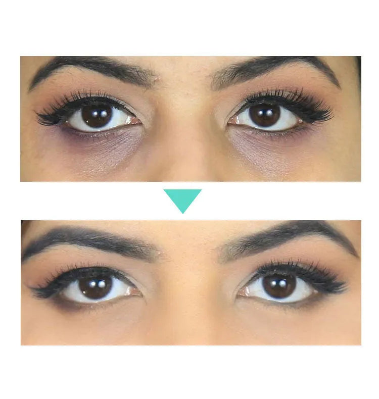 30ml women's eye cream container for targeted skincare application around eyes