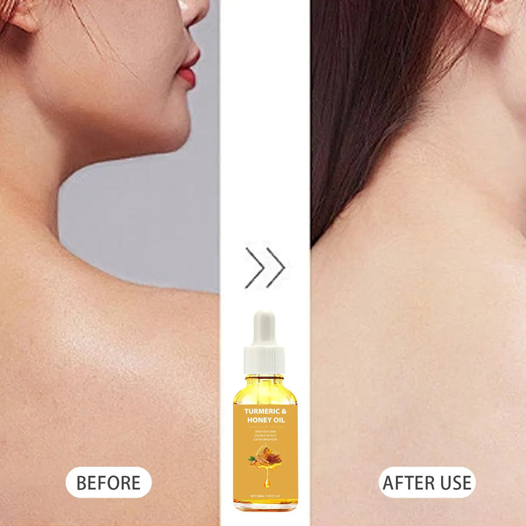 30ml bottle of turmeric honey essential oil with neutral packaging for facial beauty treatment