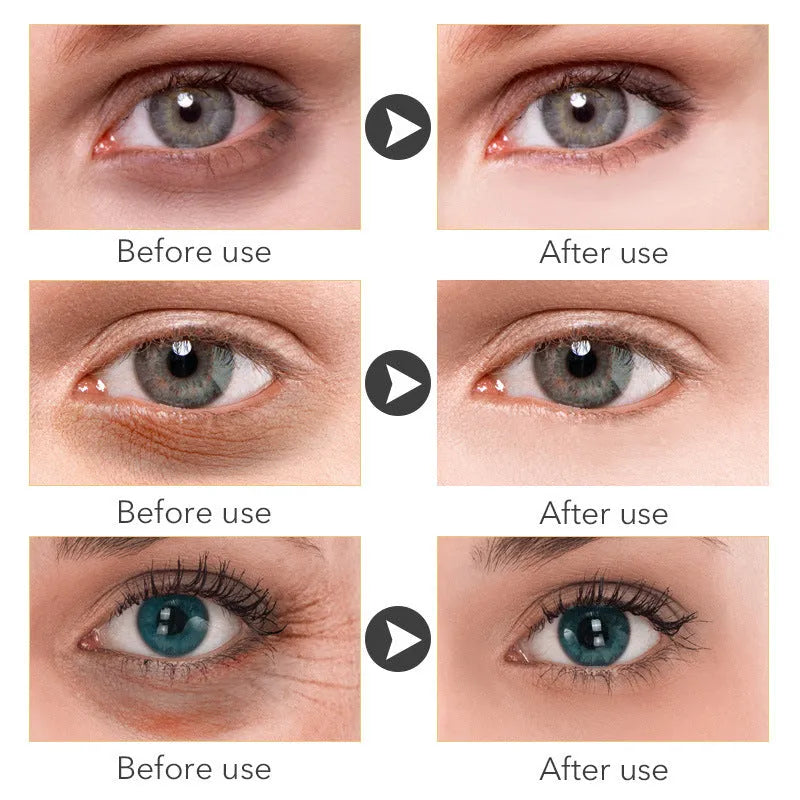 30ml women's eye cream container for targeted skincare application around eyes
