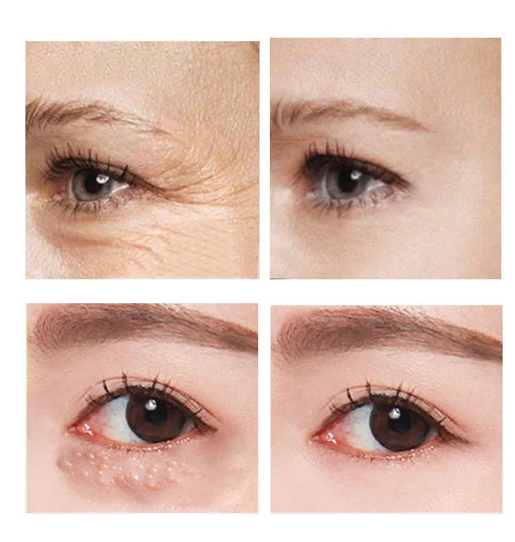 30ml women's eye cream container for targeted skincare application around eyes