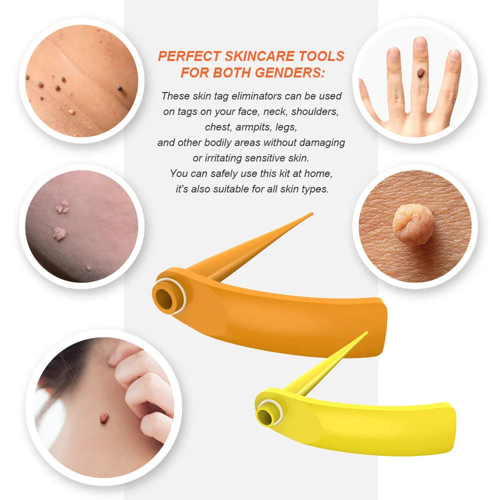 Orange-yellow mole remover tool kit with two devices, rubber rings, alcohol swabs, and accessories